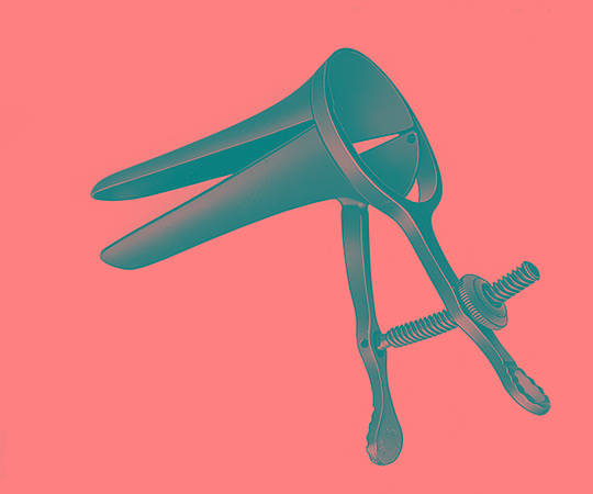 アトムメディカル クスコー・ブラック膣鏡 SSS コルポスコピー用 18250 1個(ご注文単位1個)【直送品】